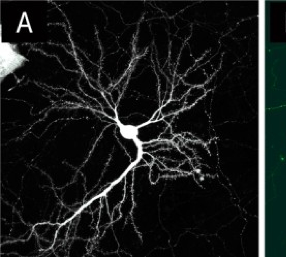 White paper: Magnetofection-Mediated Gene Delivery in Mature Primary Neurons